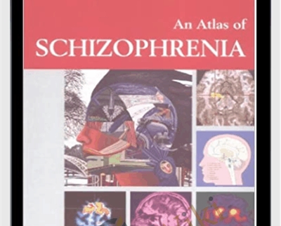 An Atlas Of Schizophrenia – Encyclopedia Of Visual Medicine Series – Martin Stefan