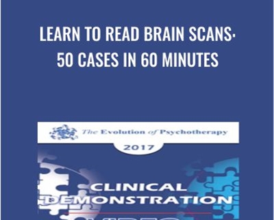 Learn to Read Brain Scans 50 cases in 60 Minutes - eBokly - Library of new courses!